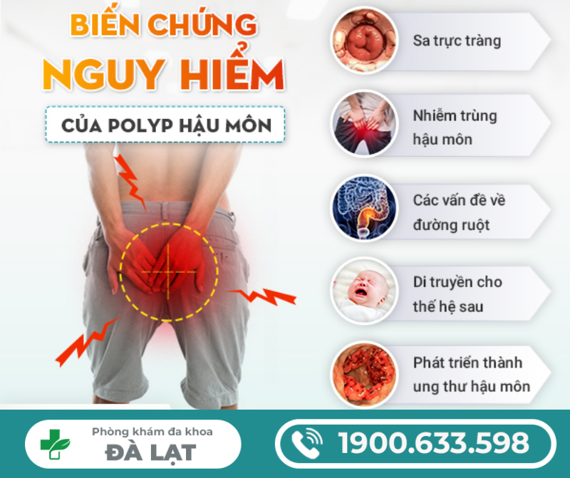 Hình ảnh minh họa